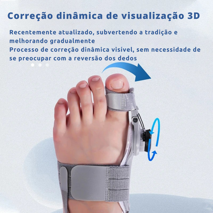 ComfortStep - Suporte de alívio para joanete