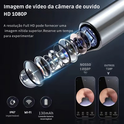 OtoClear Vision – Tecnologia Inteligente para Limpeza e Cuidados Auditivos