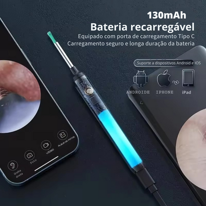 OtoClear Vision – Tecnologia Inteligente para Limpeza e Cuidados Auditivos